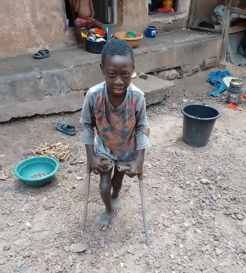 Niño caminando con muletas