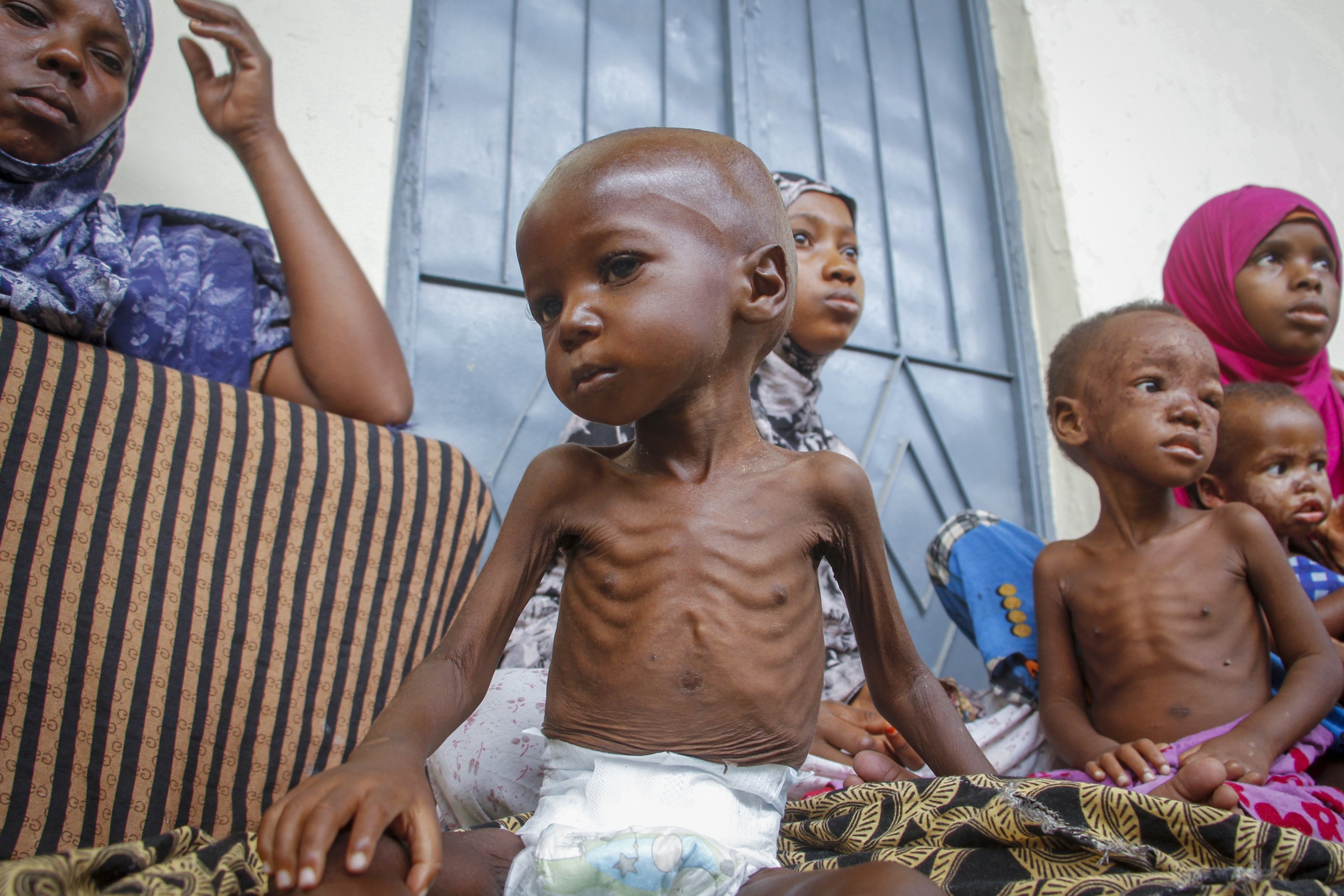 Niños africanos desnutridos esperando comida